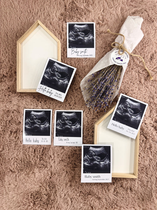 Baby Ultrasound 12 Photo Magnets